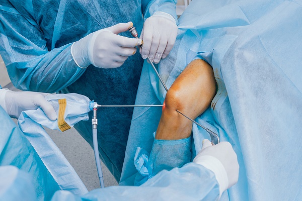 Complete Guide to Knee Arthroscopy Surgery: Procedure & Recovery