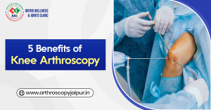 5 Benefits of Knee Arthroscopy