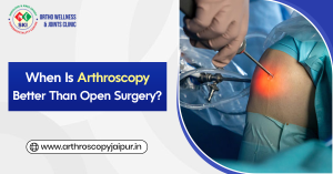 When Is Arthroscopy Better Than Open Surgery?