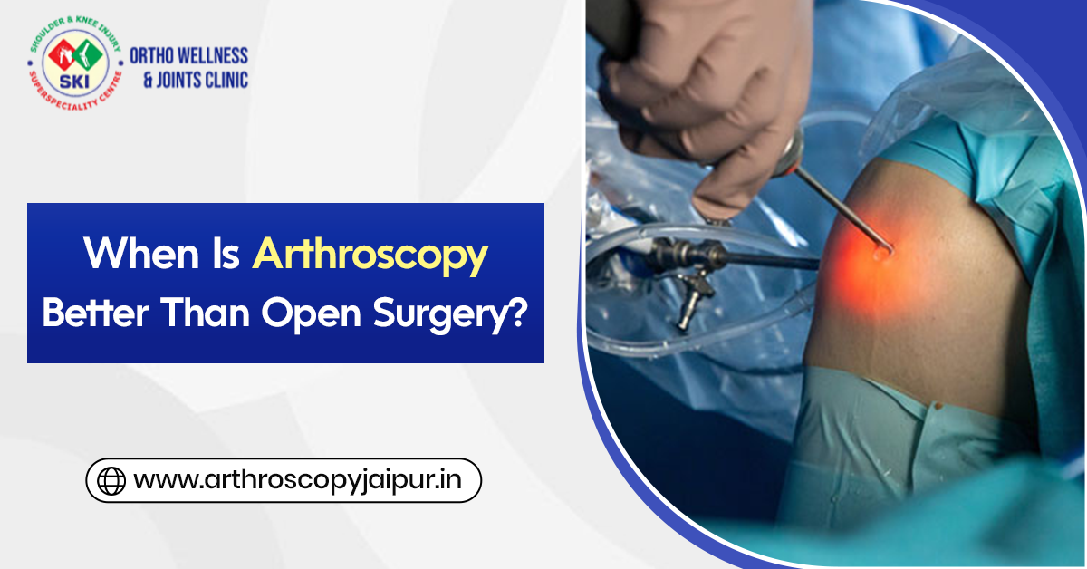 When Is Arthroscopy Better Than Open Surgery?