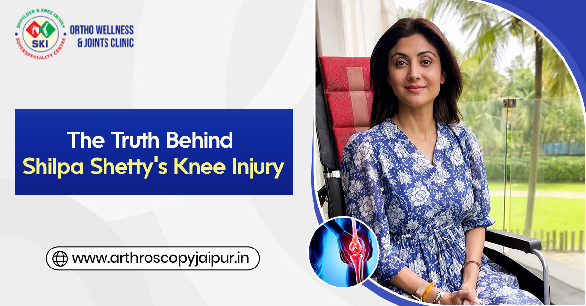 The Truth Behind Shilpa Shetty’s Knee Injury