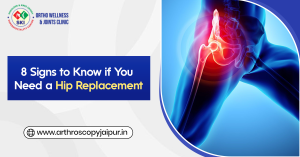 8 Signs to Know if You Need a Hip Replacement