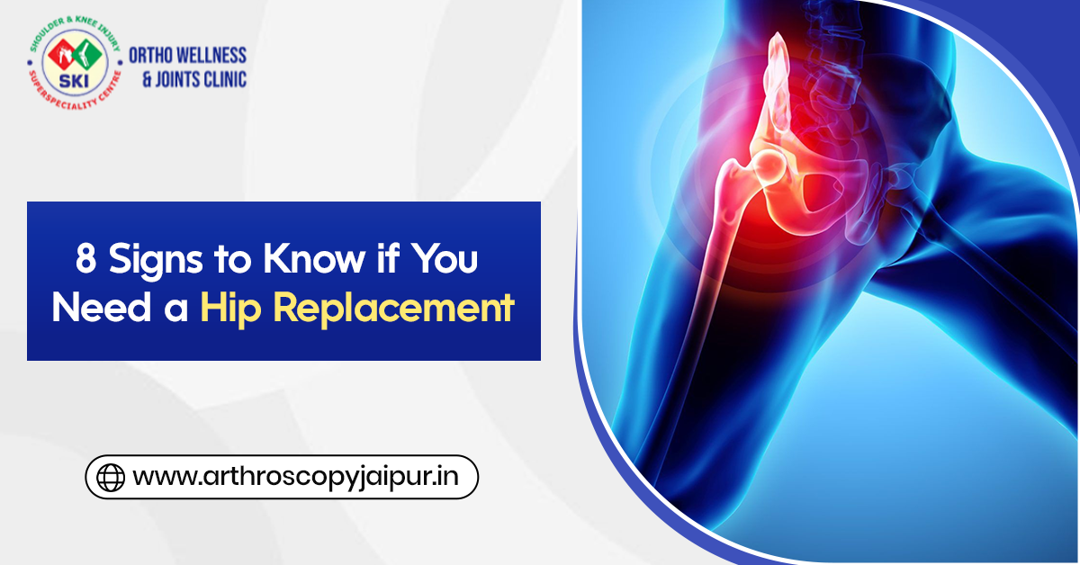 8 Signs to Know if You Need a Hip Replacement