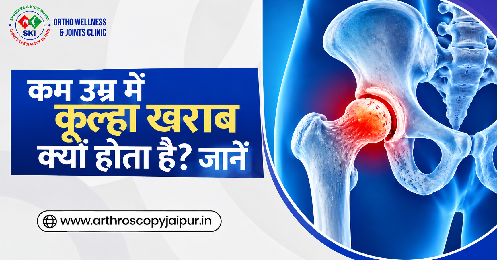 कम उम्र में Hip खराब क्यों होता है? जानें